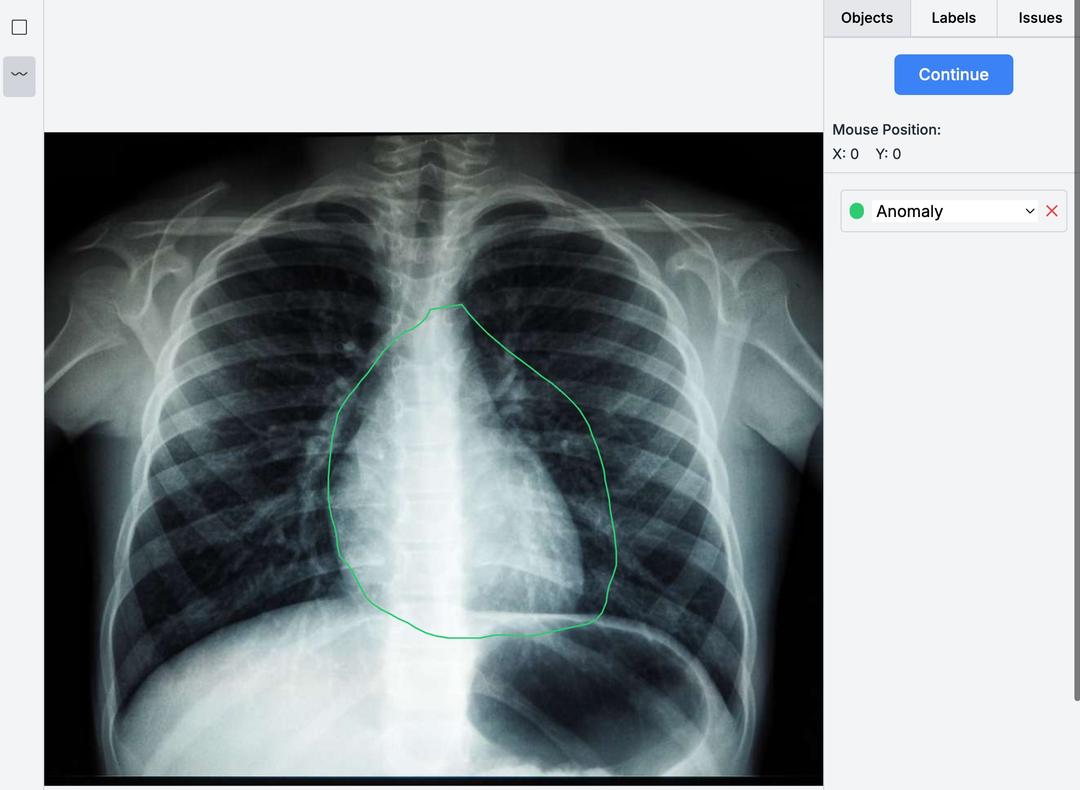 AI-Assisted Data Annotation